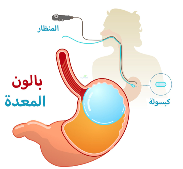 اقوي كبسولة الذكية لانقاص الوزن